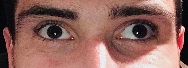 Close up of a person's face showing wide open brown eyes with dark eyebrows, looking directly at the camera—a striking...
