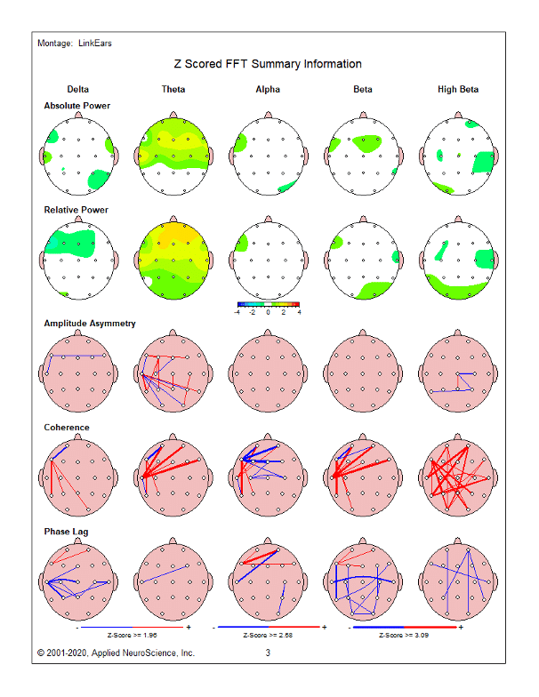Grid of EEG brain maps showing five rows (Delta, Theta, Alpha, Beta, High Beta) and five columns of analyses (Absolute...