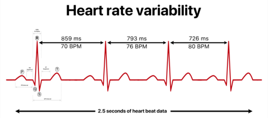 A heart rate variability chart showing three heartbeats with intervals of 859 ms (70 BPM), 793 ms (76 BPM), and 726 ms...