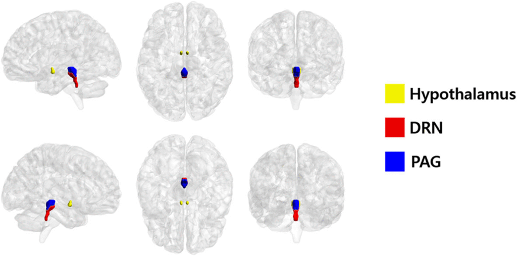 Six brain images show highlighted regions: yellow for the hypothalamus, red for the DRN, and blue for the PAG—areas often...